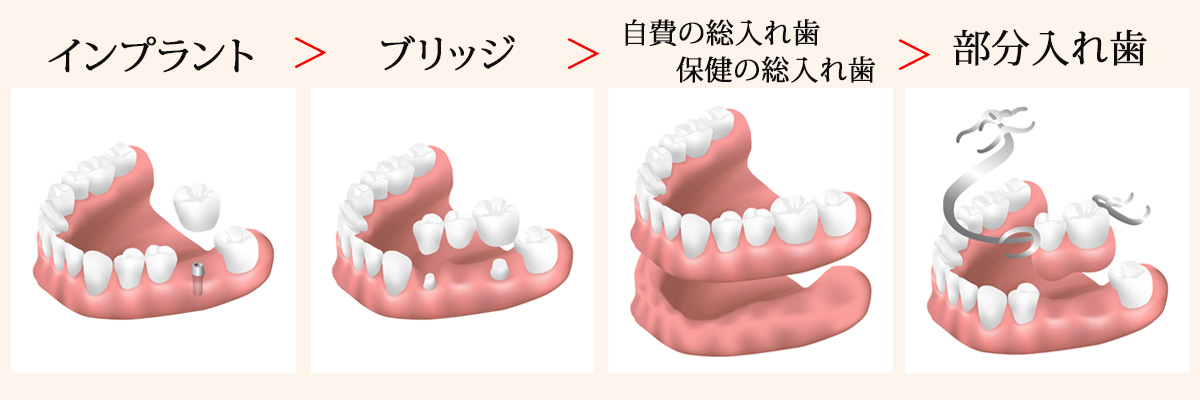 入れ歯・噛む力｜九大学研都市・ないとうファミリー歯科